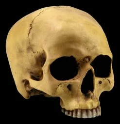 Menschlicher Schädel Ohne Unterkiefer